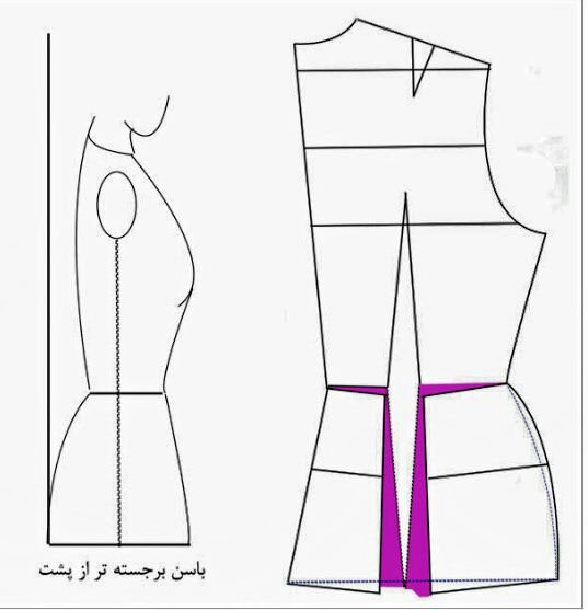ایراد اندامی